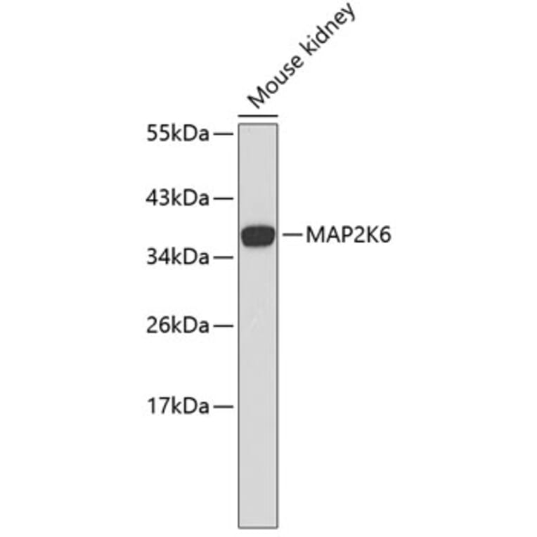 Western Blot - Anti-MAP2K6 Antibody (A0145) - Antibodies.com