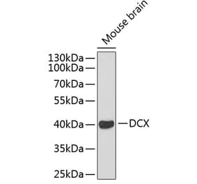 Western Blot - Anti-Doublecortin Antibody (A11118) - Antibodies.com