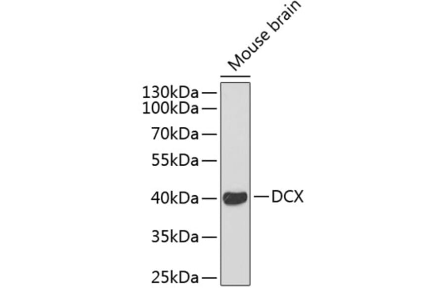 Western Blot - Anti-Doublecortin Antibody (A11118) - Antibodies.com