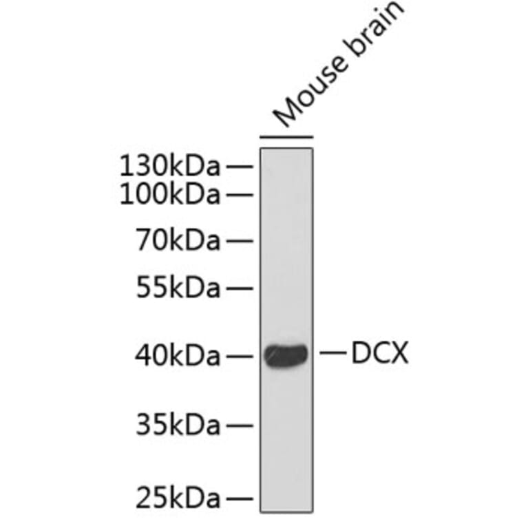 Western Blot - Anti-Doublecortin Antibody (A11118) - Antibodies.com