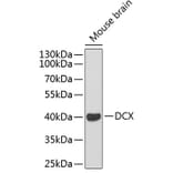 Western Blot - Anti-Doublecortin Antibody (A11118) - Antibodies.com