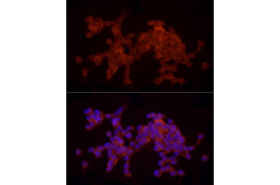 Immunofluorescence - Anti-Doublecortin Antibody (A11118) - Antibodies.com