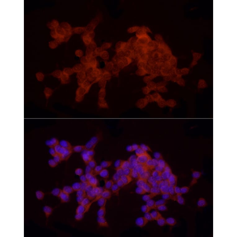 Immunofluorescence - Anti-Doublecortin Antibody (A11118) - Antibodies.com