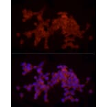 Immunofluorescence - Anti-Doublecortin Antibody (A11118) - Antibodies.com