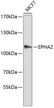 Western blot analysis of extracts of MCF-7 cells, using Anti-EPHA2 Antibody (A0167).
Secondary antibody: Goat Anti-Rabbit IgG (H+L) (HRP) (AS014) at 1:10,000 dilution.
Lysates / proteins: 25µg per lane.
Blocking buffer: 3% non-fat dry milk in TBST.