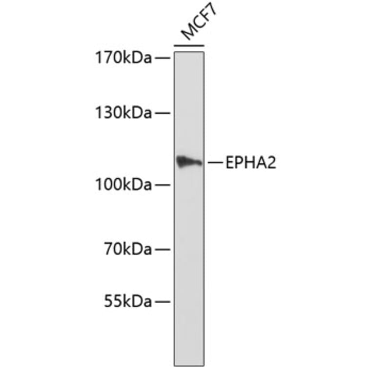 Western Blot - Anti-EPHA2 Antibody (A0167) - Antibodies.com