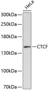 Western blot analysis of extracts of HeLa cells, using Anti-CTCF Antibody (A0171).
Secondary antibody: Goat Anti-Rabbit IgG (H+L) (HRP) (AS014) at 1:10,000 dilution.
Lysates / proteins: 25µg per lane.
Blocking buffer: 3% non-fat dry milk in TBST.