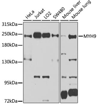 Western blot analysis of extracts of various cell lines, using Anti-MYH9 Antibody (A0173) at 1:1,000 dilution.
Secondary antibody: Goat Anti-Rabbit IgG (H+L) (HRP) (AS014) at 1:10,000 dilution.
Lysates / proteins: 25µg per lane.
Blocking buffer: 3% non-fat dry milk in TBST.
Detection: ECL Basic Kit (RM00020).
Exposure time: 15s.