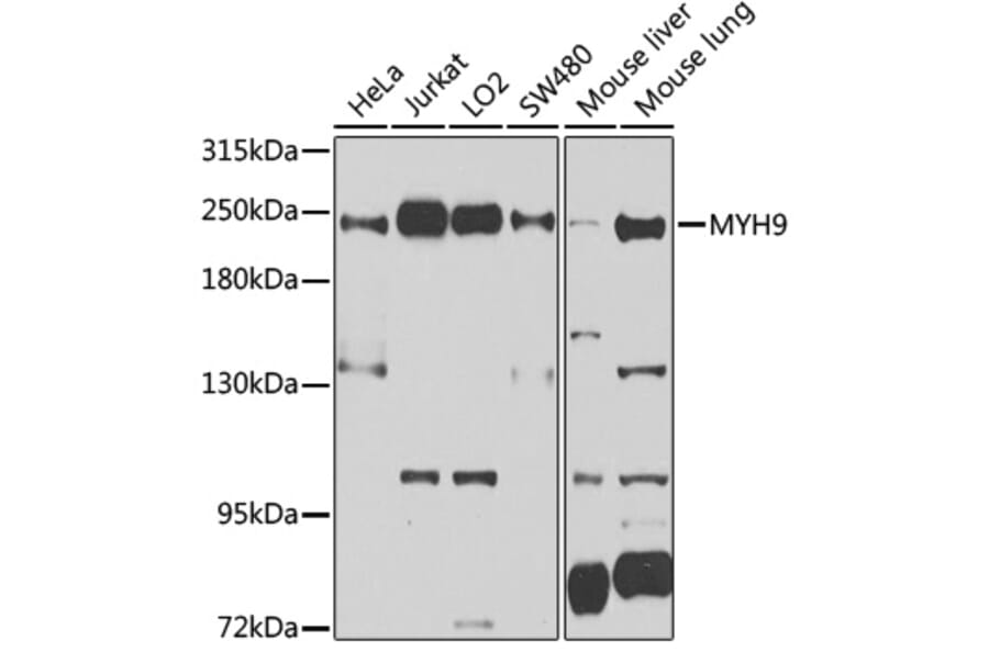Western Blot - Anti-non-muscle Myosin IIA Antibody (A11122) - Antibodies.com
