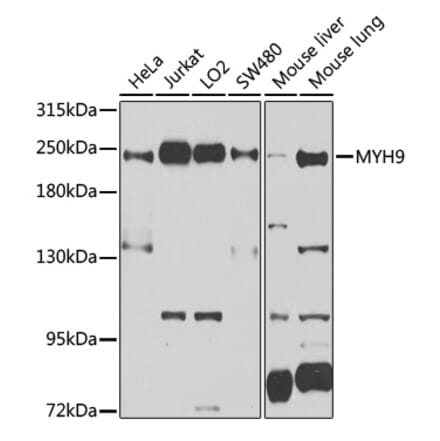 Western Blot - Anti-non-muscle Myosin IIA Antibody (A11122) - Antibodies.com