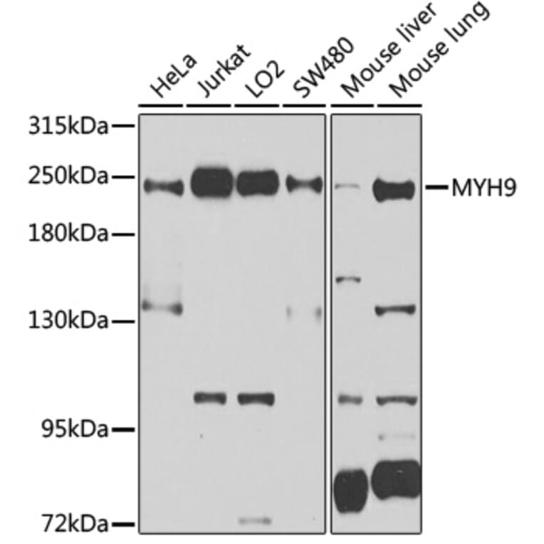 Western Blot - Anti-non-muscle Myosin IIA Antibody (A11122) - Antibodies.com