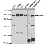 Western Blot - Anti-non-muscle Myosin IIA Antibody (A11122) - Antibodies.com