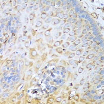 Immunohistochemistry of paraffin-embedded human esophagus using Anti-MYH9 Antibody (A0173) at dilution of 1:100 (40x lens).