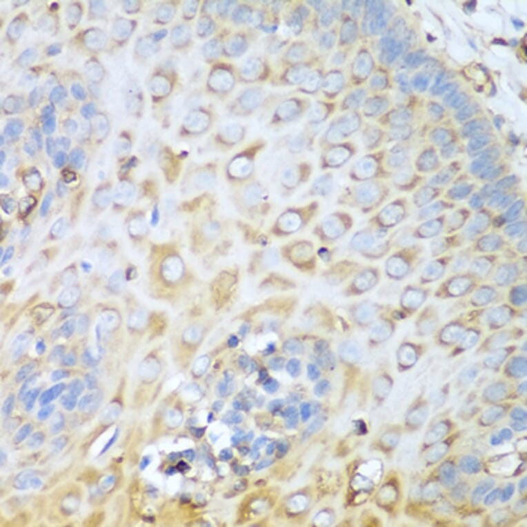 Immunohistochemistry - Anti-non-muscle Myosin IIA Antibody (A11122) - Antibodies.com