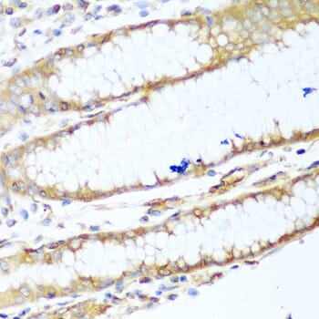 Immunohistochemistry of paraffin-embedded human stomach using Anti-MYH9 Antibody (A0173) at dilution of 1:100 (40x lens).