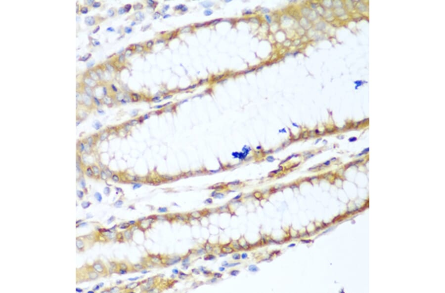 Immunohistochemistry - Anti-non-muscle Myosin IIA Antibody (A11122) - Antibodies.com