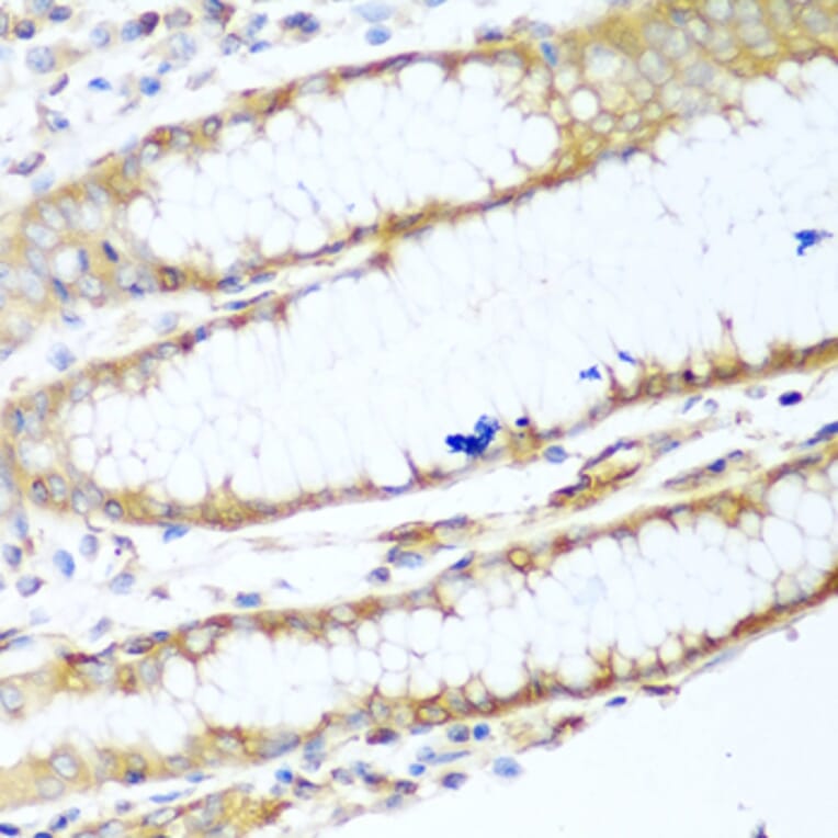 Immunohistochemistry - Anti-non-muscle Myosin IIA Antibody (A11122) - Antibodies.com