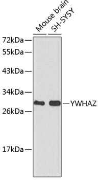 Western blot analysis of extracts of various cell lines, using Anti-YWHAZ Antibody (A0174).
Secondary antibody: Goat Anti-Rabbit IgG (H+L) (HRP) (AS014) at 1:10,000 dilution.
Lysates / proteins: 25µg per lane.
Blocking buffer: 3% non-fat dry milk in TBST.