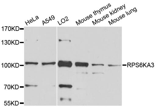 Western blot analysis of extracts of various cell lines, using Anti-RPS6KA3 Antibody (A0177) at 1:1,000 dilution.
Secondary antibody: Goat Anti-Rabbit IgG (H+L) (HRP) (AS014) at 1:10,000 dilution.
Lysates / proteins: 25µg per lane.
Blocking buffer: 3% non-fat dry milk in TBST.
Detection: ECL Basic Kit (RM00020).
Exposure time: 30s.