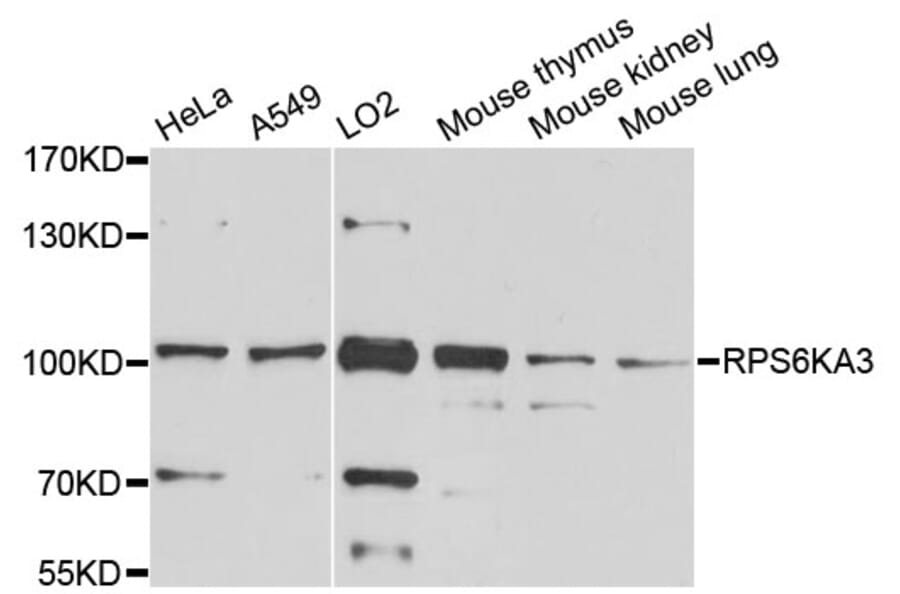 Western Blot - Anti-RPS6KA3 Antibody (A0177) - Antibodies.com