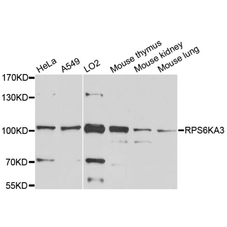 Western Blot - Anti-RPS6KA3 Antibody (A0177) - Antibodies.com