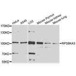Western Blot - Anti-RPS6KA3 Antibody (A0177) - Antibodies.com