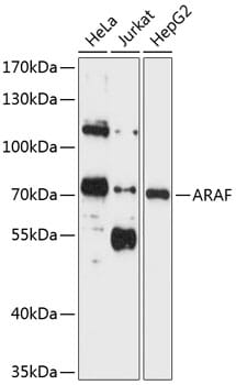 Western blot analysis of extracts of various cell lines, using Anti-ARAF Antibody (A0180) at 1:1,000 dilution. Secondary antibody: Goat Anti-Rabbit IgG (H+L) (HRP) (AS014) at 1:10,000 dilution. Lysates / proteins: 25µg per lane. Blocking buffer: 3% non-fat dry milk in TBST. Detection: ECL Enhanced Kit (RM00021). Exposure time: 5s.