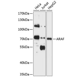 Western Blot - Anti-A RAF Antibody (A11125) - Antibodies.com