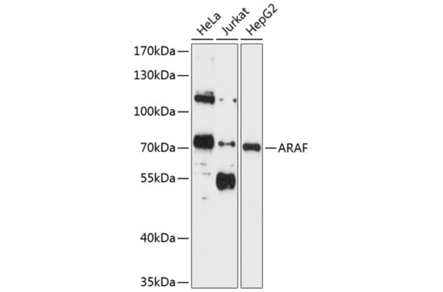 Western Blot - Anti-A RAF Antibody (A11125) - Antibodies.com