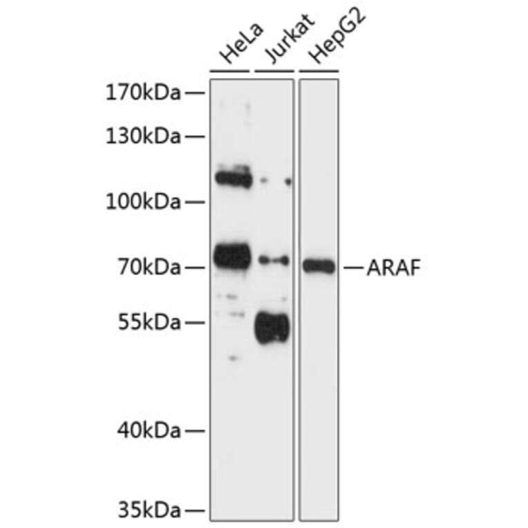 Western Blot - Anti-A RAF Antibody (A11125) - Antibodies.com