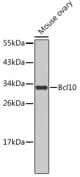 Western blot analysis of extracts of mouse ovary, using Anti-BCL10 Antibody (A0191).
Secondary antibody: Goat Anti-Rabbit IgG (H+L) (HRP) (AS014) at 1:10,000 dilution.
Lysates / proteins: 25µg per lane.
Blocking buffer: 3% non-fat dry milk in TBST.