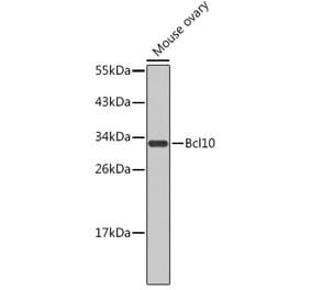 Western Blot - Anti-Bcl10 Antibody (A11126) - Antibodies.com