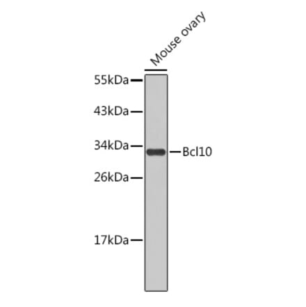 Western Blot - Anti-Bcl10 Antibody (A11126) - Antibodies.com