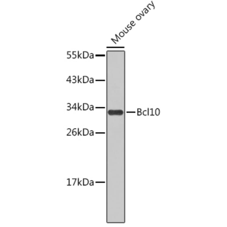 Western Blot - Anti-Bcl10 Antibody (A11126) - Antibodies.com