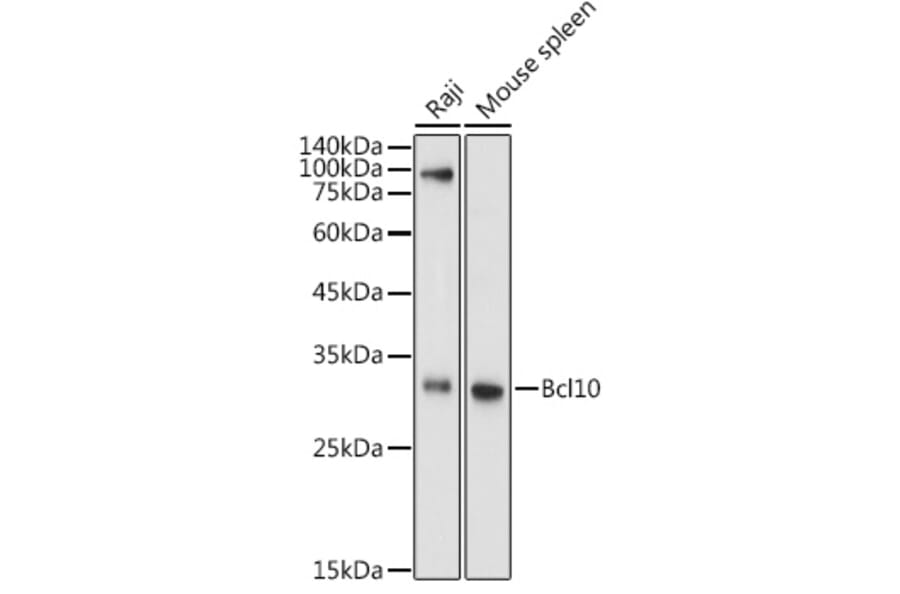 Western Blot - Anti-Bcl10 Antibody (A11126) - Antibodies.com