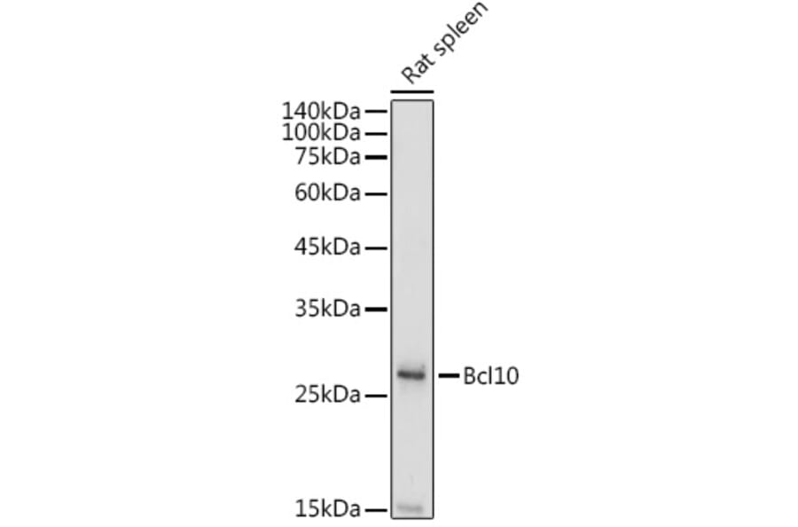 Western Blot - Anti-Bcl10 Antibody (A11126) - Antibodies.com
