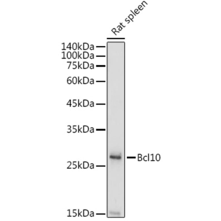 Western Blot - Anti-Bcl10 Antibody (A11126) - Antibodies.com
