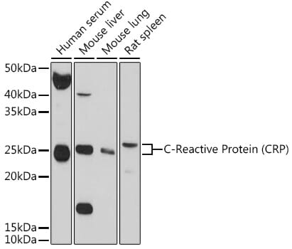Western blot analysis of extracts of rat brain, using Anti-CRP Antibody (A0224) at 1:1,000 dilution.
Secondary antibody: Goat Anti-Rabbit IgG (H+L) (HRP) (AS014) at 1:10,000 dilution.
Lysates / proteins: 25µg per lane.
Blocking buffer: 3% non-fat dry milk in TBST.
Detection: ECL Enhanced Kit (RM00021).
Exposure time: 30s.
