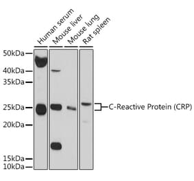 Western Blot - Anti-C Reactive Protein Antibody (A11127) - Antibodies.com