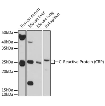 Western Blot - Anti-C Reactive Protein Antibody (A11127) - Antibodies.com