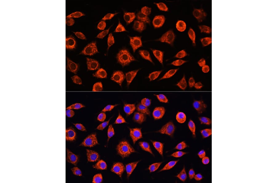 Immunofluorescence - Anti-C Reactive Protein Antibody (A11127) - Antibodies.com