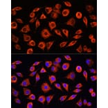 Immunofluorescence - Anti-C Reactive Protein Antibody (A11127) - Antibodies.com
