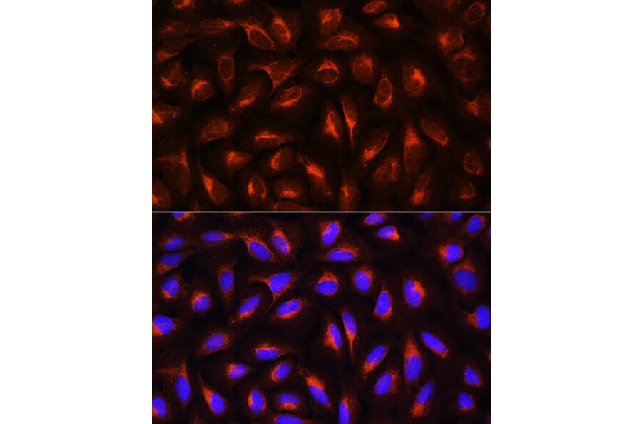 Immunofluorescence - Anti-C Reactive Protein Antibody (A11127) - Antibodies.com