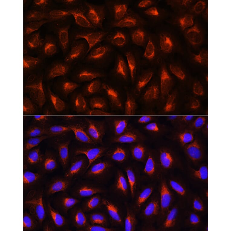 Immunofluorescence - Anti-C Reactive Protein Antibody (A11127) - Antibodies.com
