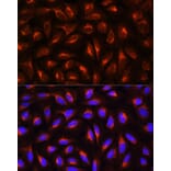 Immunofluorescence - Anti-C Reactive Protein Antibody (A11127) - Antibodies.com