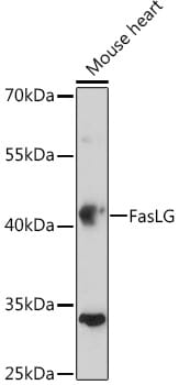Western blot analysis of extracts of Mouse heart, using Anti-FasLG Antibody (A0234) at 1:500 dilution.
Secondary antibody: Goat Anti-Rabbit IgG (H+L) (HRP) (AS014) at 1:10,000 dilution.
Lysates / proteins: 25µg per lane.
Blocking buffer: 3% non-fat dry milk in TBST.
Detection: ECL Enhanced Kit (RM00021).
Exposure time: 5min.