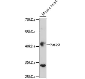 Western Blot - Anti-Fas Ligand Antibody (A11128) - Antibodies.com