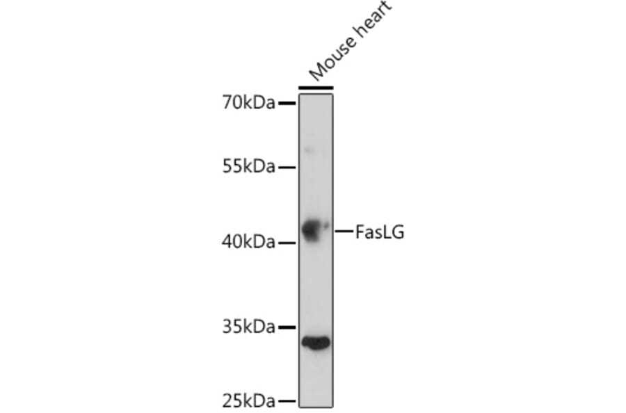 Western Blot - Anti-Fas Ligand Antibody (A11128) - Antibodies.com