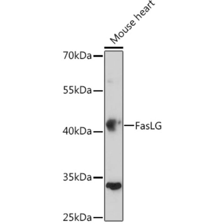 Western Blot - Anti-Fas Ligand Antibody (A11128) - Antibodies.com