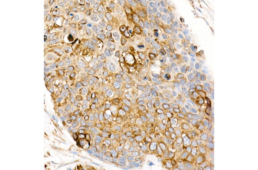 Immunohistochemistry - Anti-Fas Ligand Antibody (A11128) - Antibodies.com
